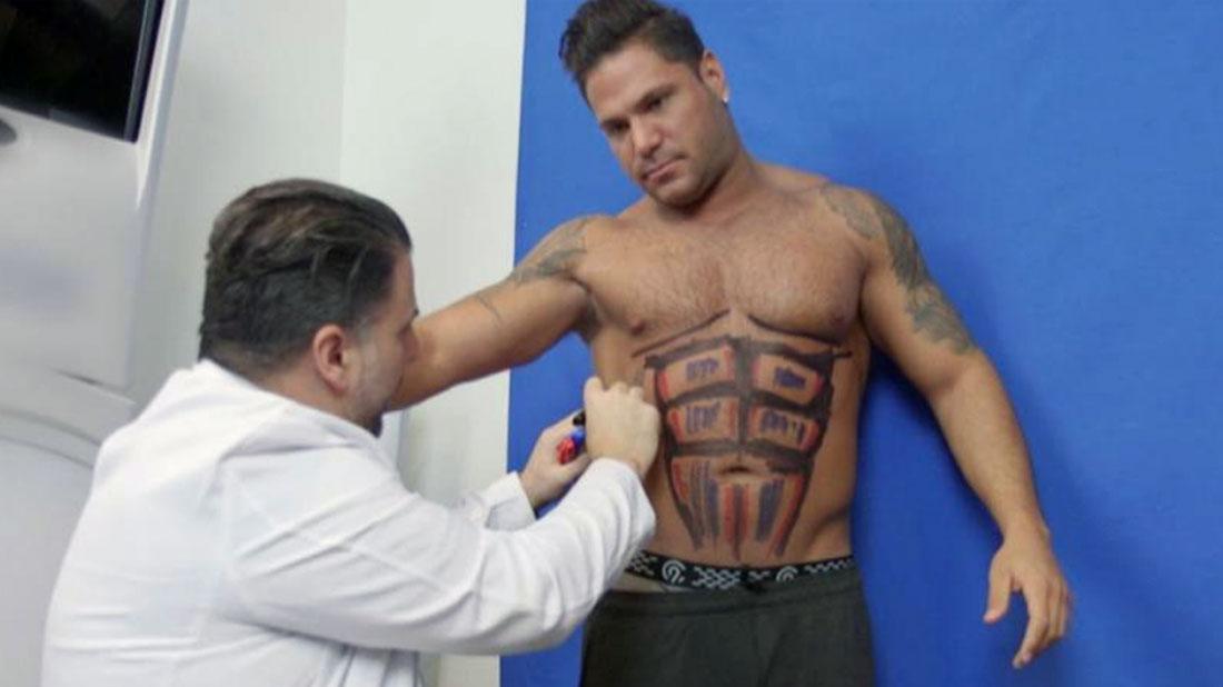 Jersey Shore Star Ronnie Ortiz Magro Gets Lipo For Pack Abs