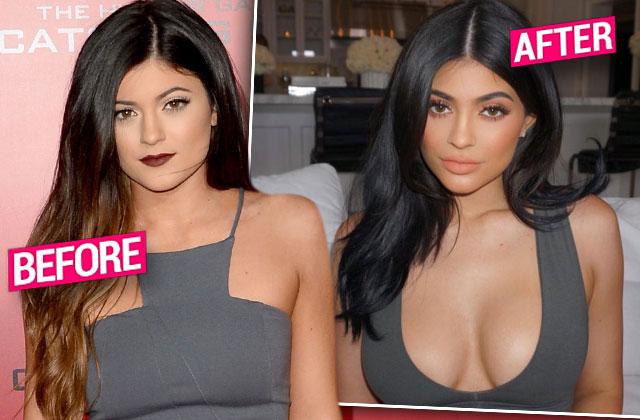 Total Transformation See The Eye Popping Evolution Of Kylie Jenner S Boobs