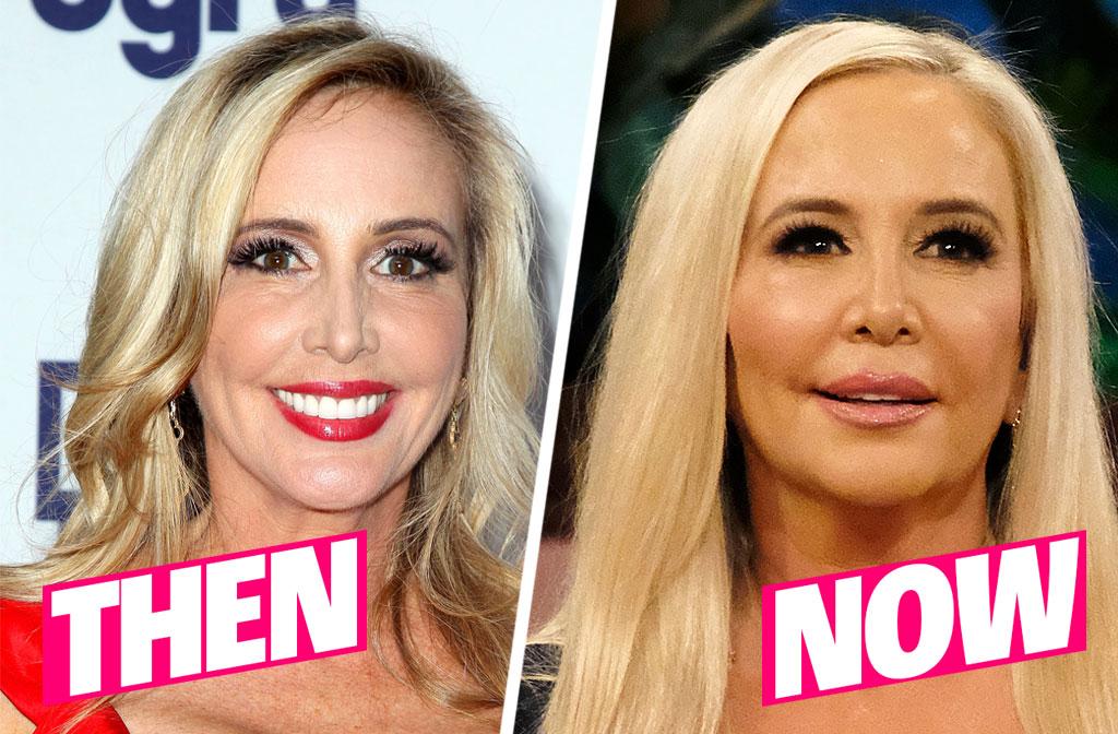 RHOC Cast Plastic Surgery Transformations Exposed Top Docs