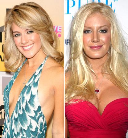 //heidi montag addicted to plastic surgery