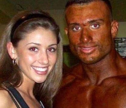 World's Worst Tanning Disasters