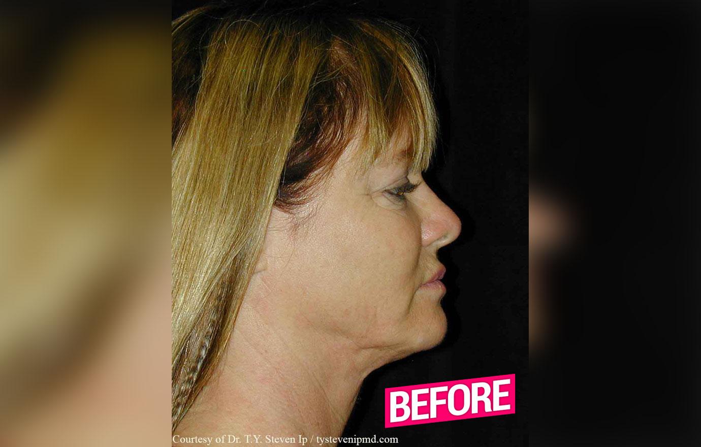 //rhoc Jeana Keough plastic surgery makeover