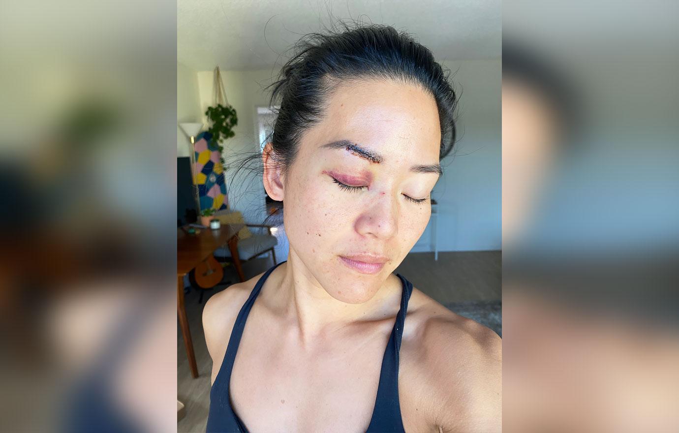 michelle yi survivor fiji stabbed beaten homeless woman santa monica r