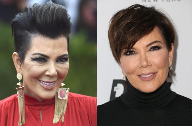 Facelifts! Botox! Stars With Freaky Faces After Botched Plastic Surgery ...