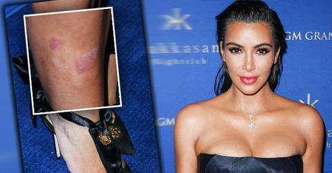 kim kardashian rash legs boobs cleavage las vegas party pics