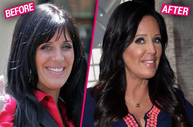 Millionaire Makeover Patti Stanger S DRAMATIC Plastic Surgery Secrets   Patti Stanger Plastic Surgery Makeover Pp 