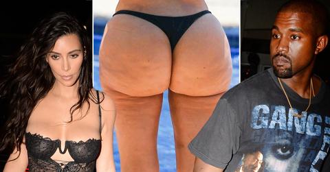Kanye West and Kim Kardashian Butt Surgery