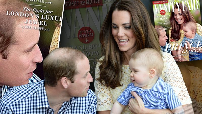 //duke of cambridge balding wide