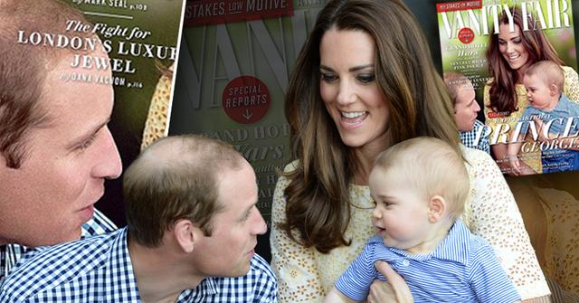 //duke of cambridge balding wide