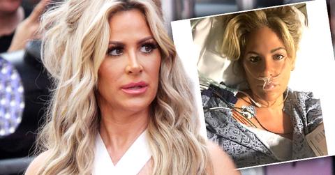 //Kim Zolciak Stroke Plastic Surgery pp