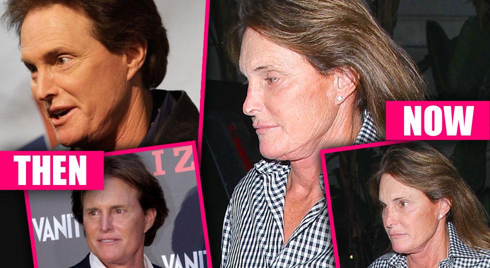 Niptuck Bruce Jenner Reportedly Gets Nose Job Before This Summers Sex Swap Big Surgerysee