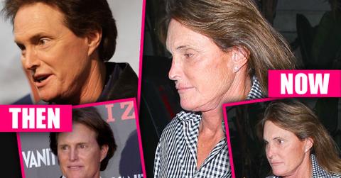 Bruce Jenner Nose Job