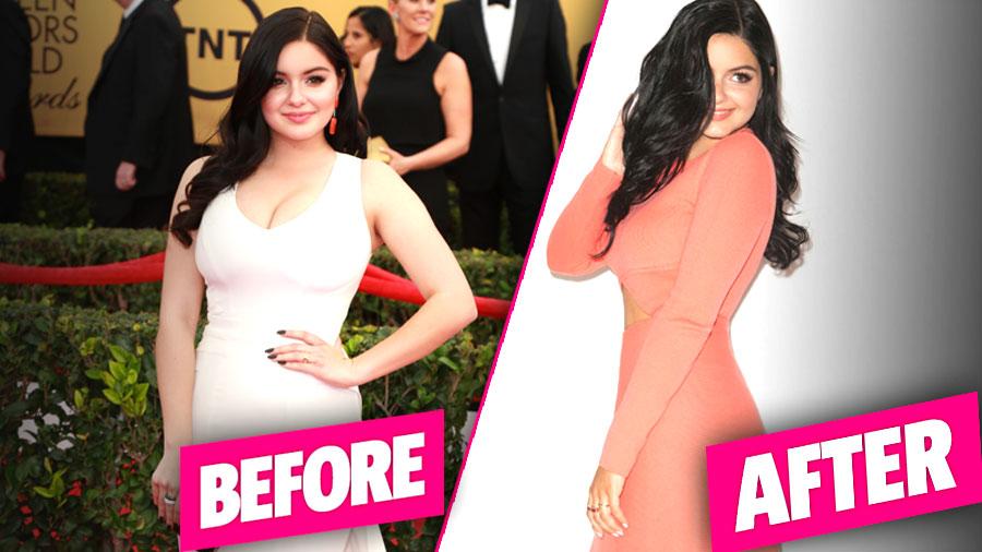 Modern Family actress Ariel Winter gets a breast reduction