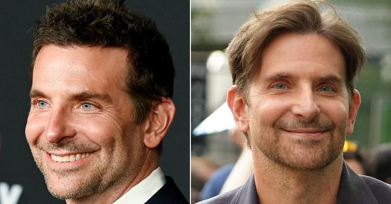 Bradley Cooper’s Plastic Surgery Disaster! Inside His Bizarre New Look