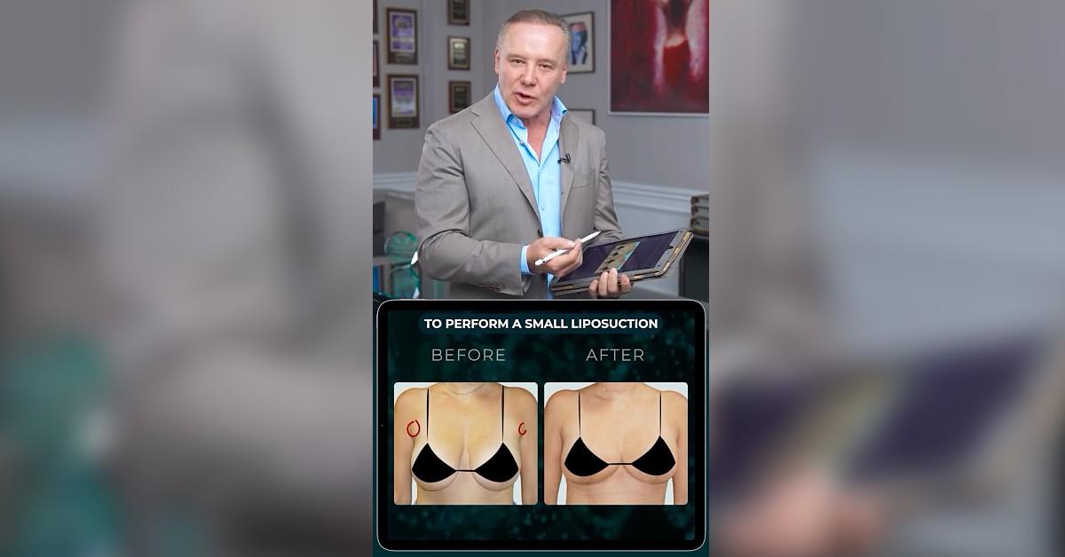 RHOM's Leonard Hochstein Sued Over a Botched Breast Plastic Surgery