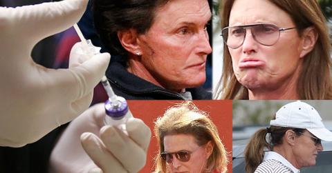 //bruce jenner sex change spent transition hair botox fillers