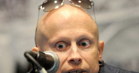 //verne troyer suicidal pysch ward pp