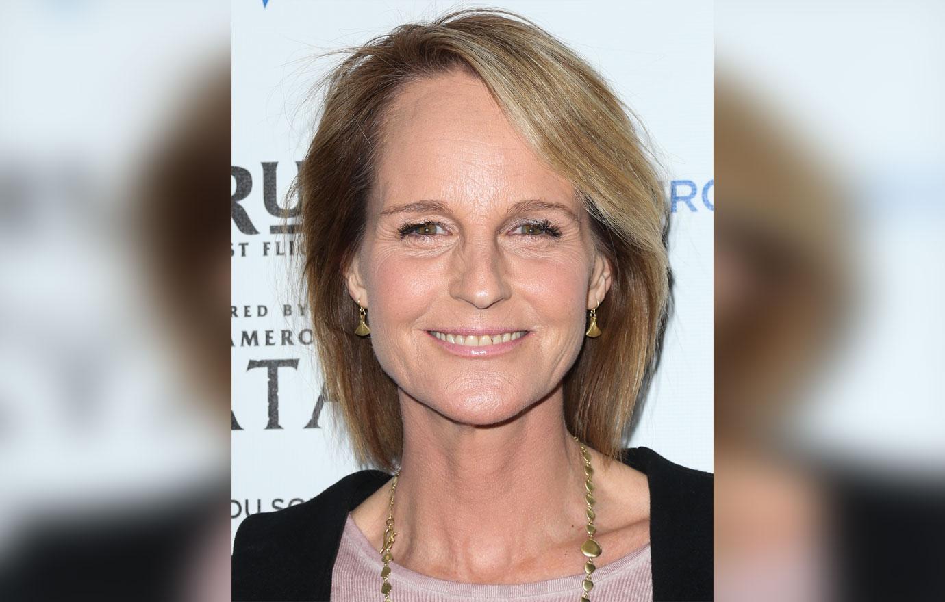 Helen Hunt Plastic Surgery