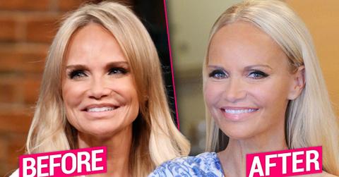 Kristin Chenoweth in 2015 on the Left, Kristin Chenoweth in 2019 On the Right