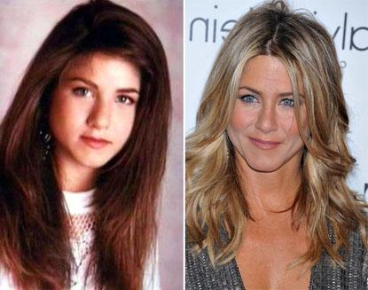 //jennifer aniston nose job