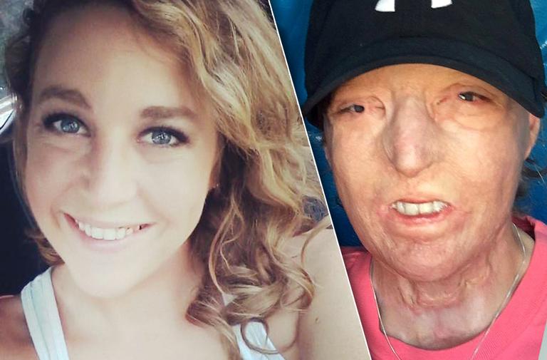 Burn Victim Courtney Waldon's Mom Slams Monster Husband Who Left Her
