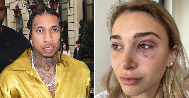 tyga deletes all traces of ex girlfriend camaryn swanson domestic violence arrest felony
