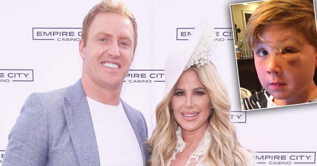 kroy biermann kim zolciak vacation kash biermann dog bite lawsuit pics