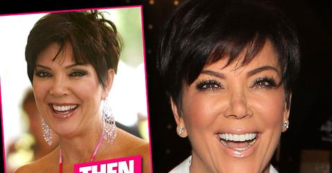 Kris Jenner's Nose Is Collapsing After Surgery Disasters, Claims Report