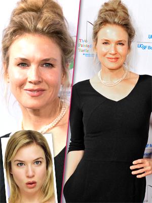 //renee zellweger hits red carpet first time in five months nearly unrecognizable tall