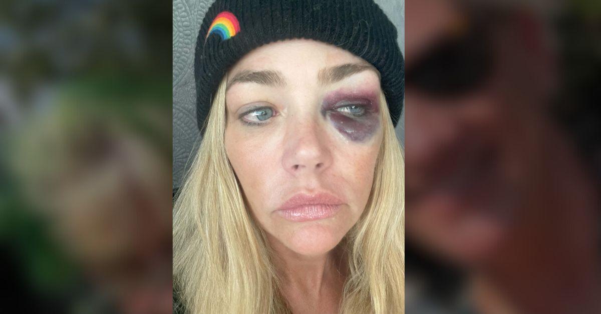 Photo of Denise Richards