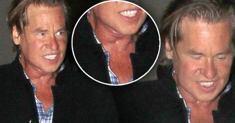 Val Kilmer Throat Tumor Rumors