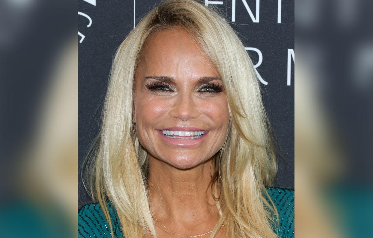 Kristin Chenoweth Plastic Surgery Makeover Exposed By Top Docs