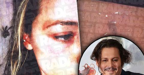 Amber Heard Johnny Depp Abuse Claims Photo Damage
