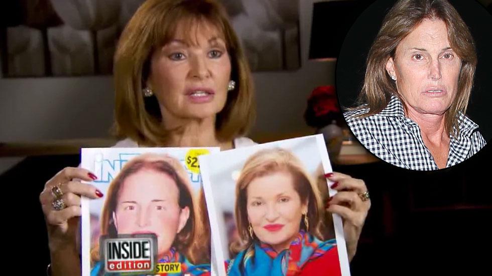 Stephanie Beacham Reacts To InTouch's Bruce Jenner Cover​