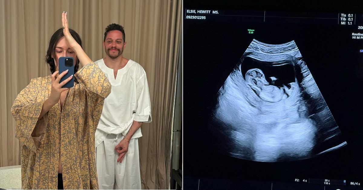 Split photo of Elsie Hewitt, Pete Davidson and Ultrasound