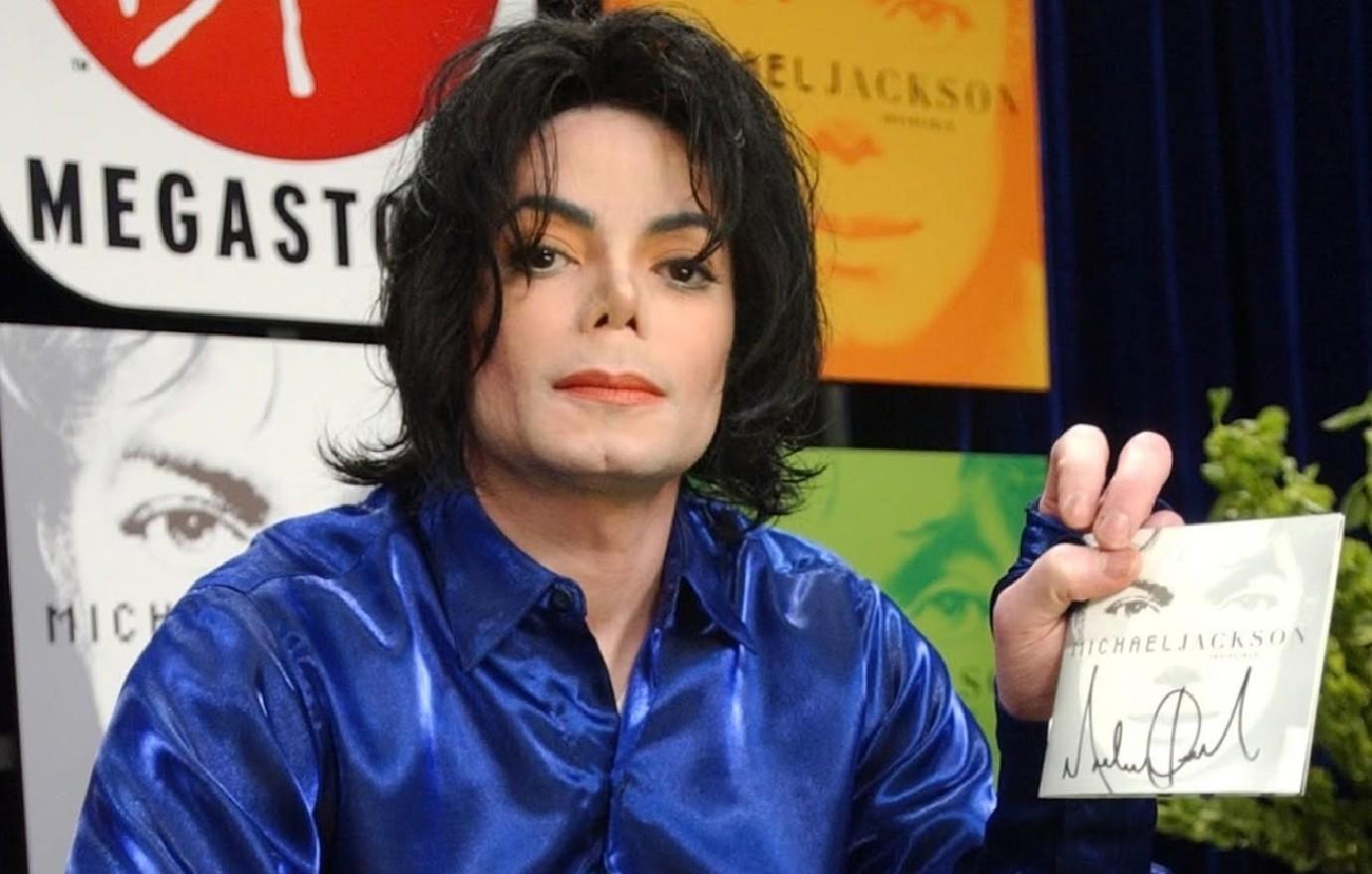 image of Michael Jackson lived with vitiligo for much of his adult life.