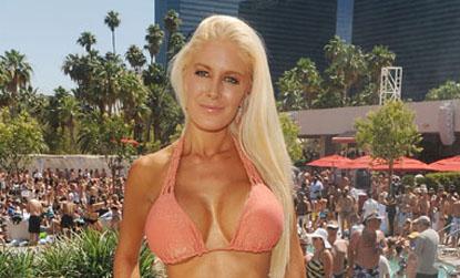 //heidi montag reality star plastic surgery