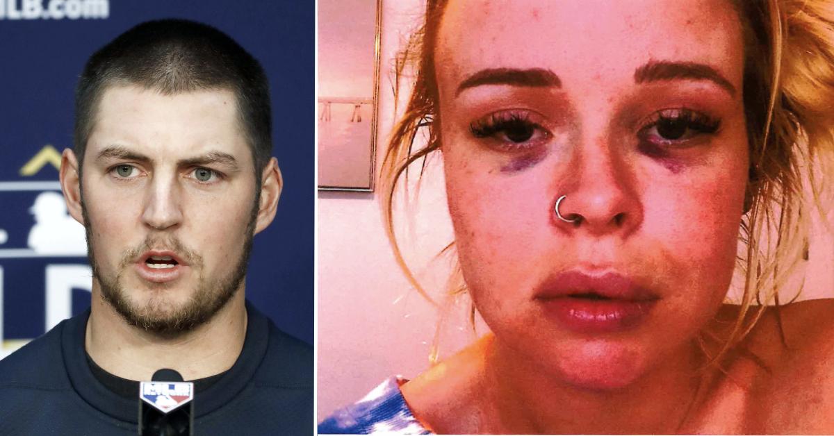 Trevor Bauer accuser 'EDITED her sexual assault injury photos' and 'lied  about having a fractured skull