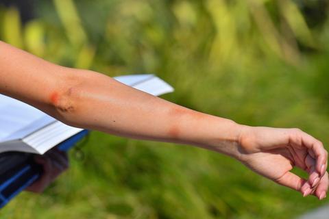 farrah abraham photos injuries cuts bruises violent arrest