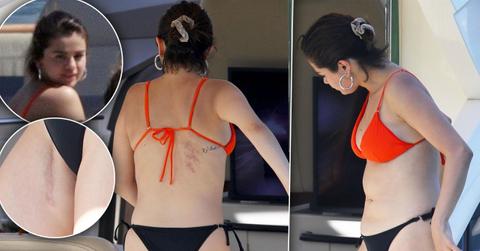 Selena Gomez Kidney Scar Bikini