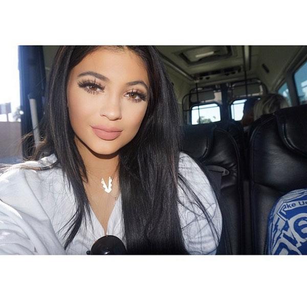 Kylie Jenner Lip Enhancement Surgery