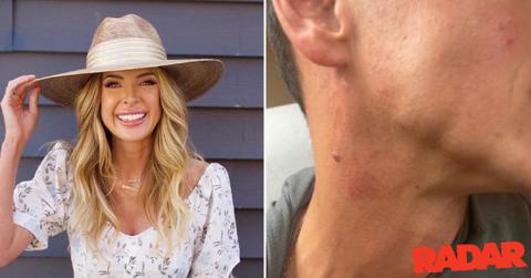 lindsie chrisley assault ex boyfriend injury photos heels restraining order pp