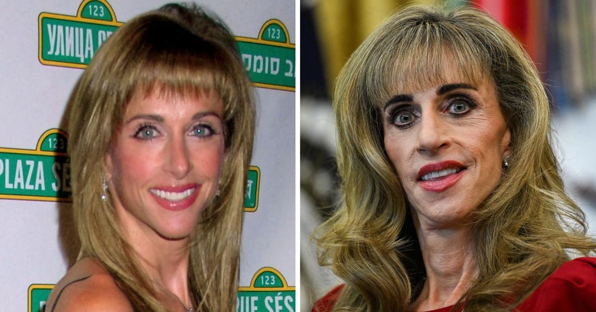 Susan Dell Plastic Surgery Rumors Erupt After Billionaire's…