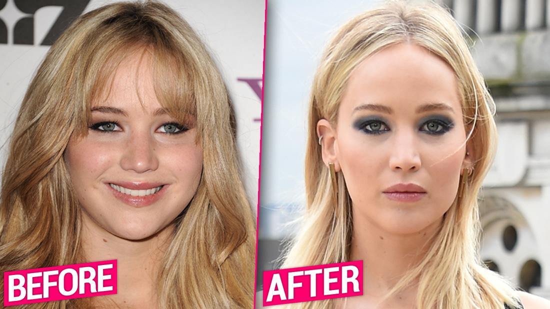 Jennifer Lawrence Before After Plastic Surgery Makeover Exposed.