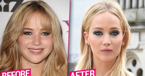 Jennifer Lawrence Plastic Surgery Makeover Exposed By Top Doctors