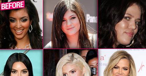 Kardashian Jenner Plastic Surgery