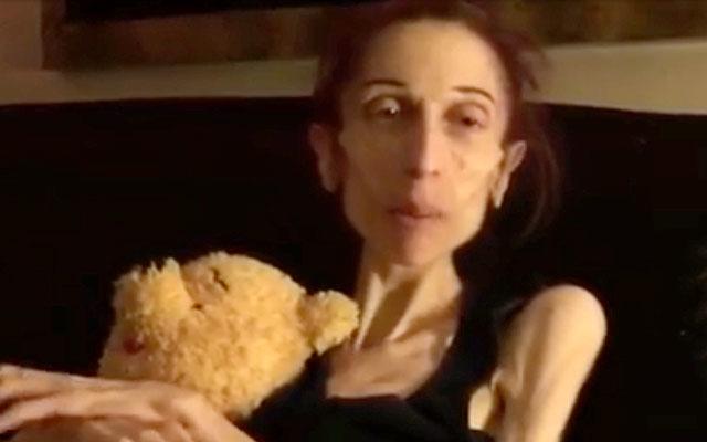 // pound anorexic woman rachael farrokh recovery