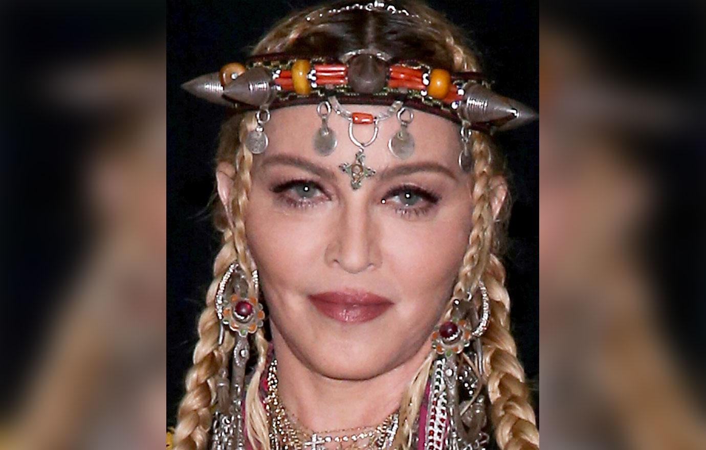 Madonna Before After Plastic Surgery