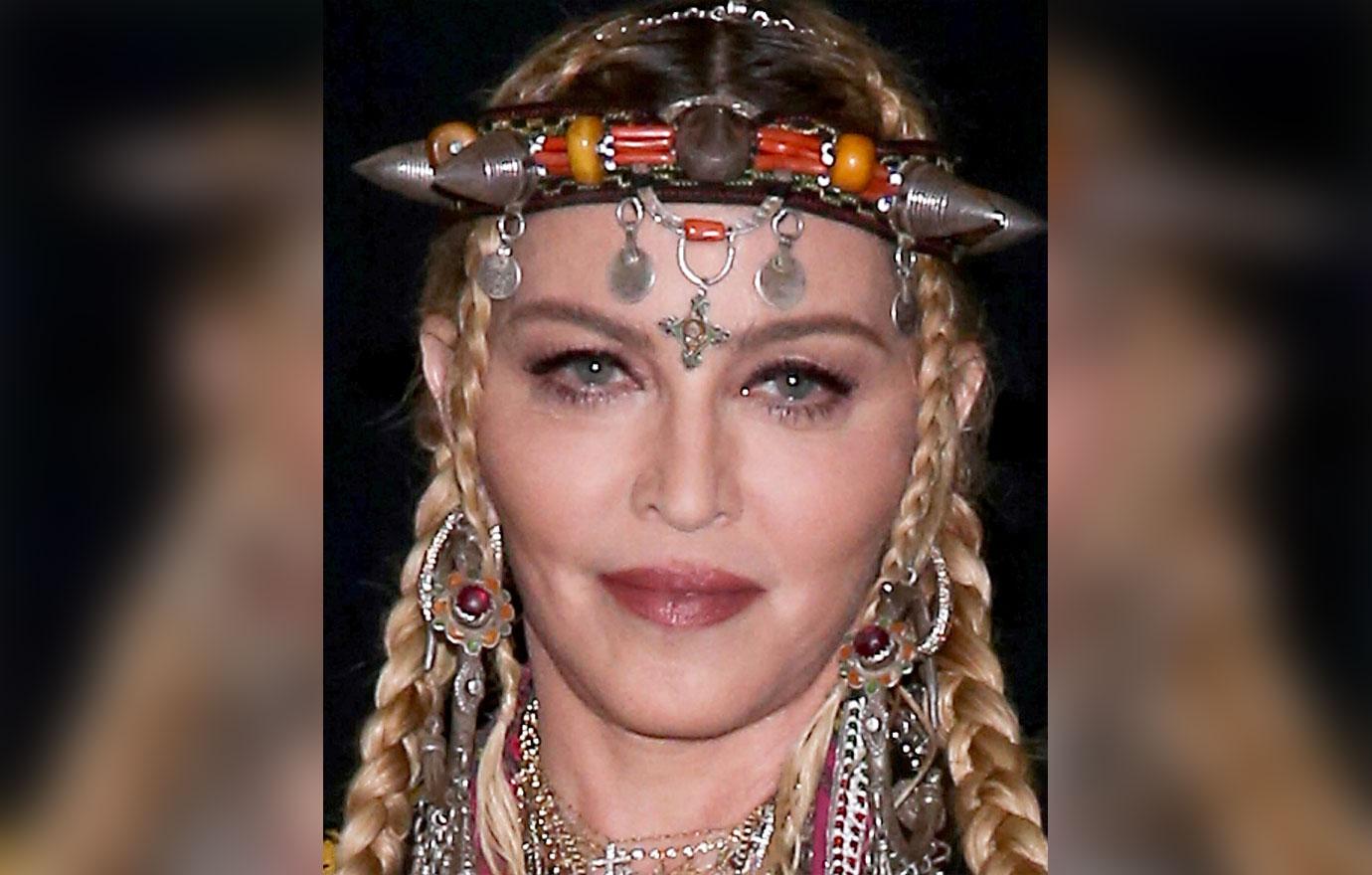 Madonnas Shocking Plastic Surgery Makeover Exposed By Top Docs 2508