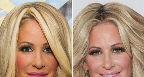 //kim zolciak before and after square getty